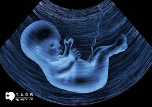 北京代生男孩：﻿试管移植成功后的保胎攻略揭秘：做好这三点顺利迎接宝宝到来